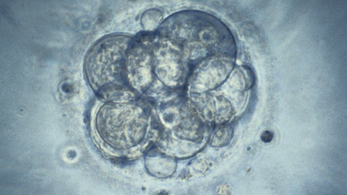 最新のIVF手法、ミトコンドリア補充療法が英国で初実施へ